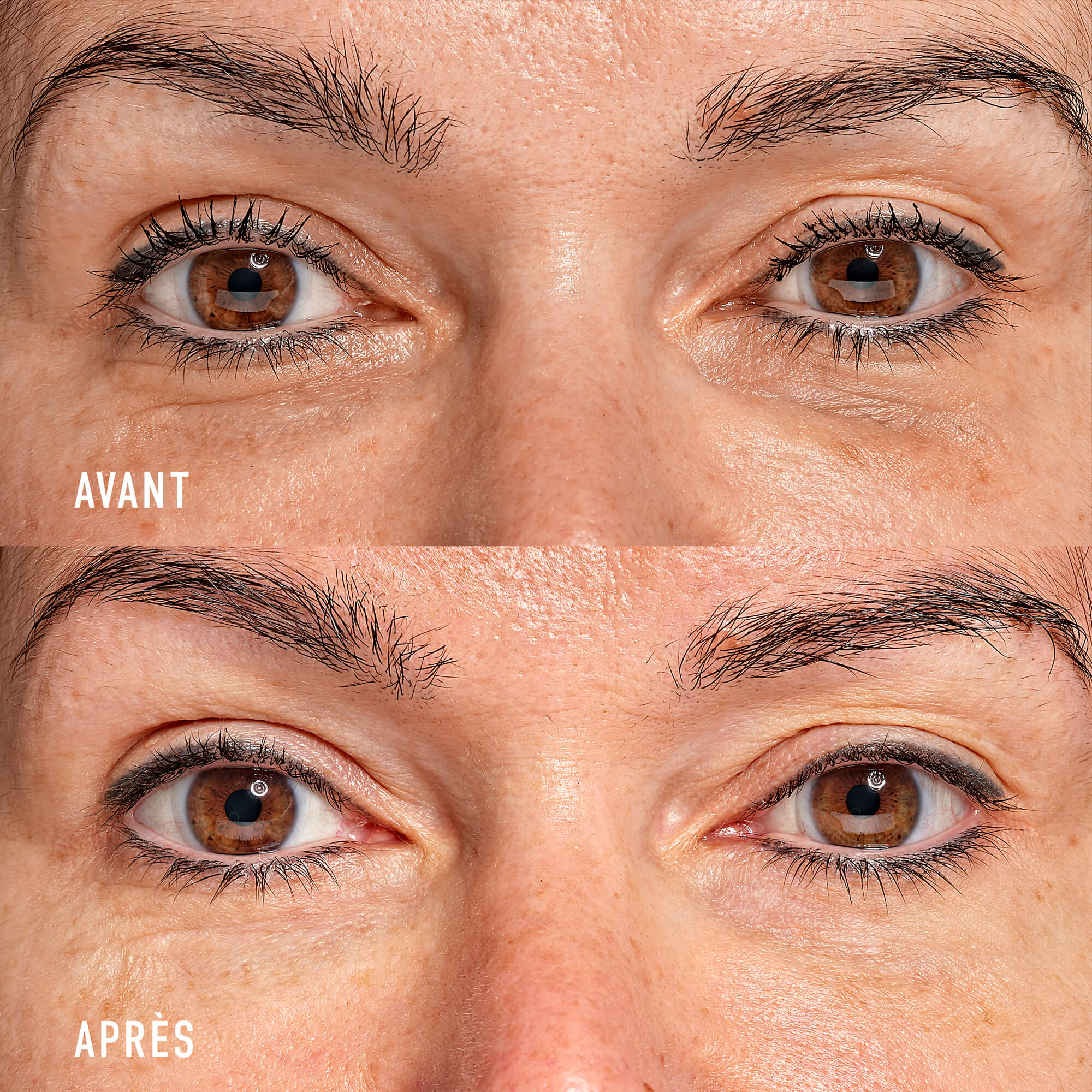 Eye Recipe Soin Contour des Yeux Global - Image 6
